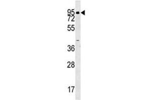 ABP1 antibody western blot analysis in human K562 lysate. (DAO 抗体  (AA 71-100))