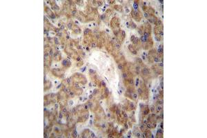 CXCL12 Antibody (C-term) (ABIN657319 and ABIN2846394) immunohistochemistry analysis in formalin fixed and paraffin embedded human liver tissue followed by peroxidase conjugation of the secondary antibody and DAB staining. (CXCL12 抗体  (C-Term))