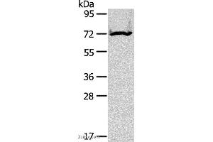 Western blot analysis of Mouse kidney tissue, using CPT2 Polyclonal Antibody at dilution of 1:200 (CPT2 抗体)