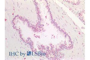 ABIN2613436 (5µg/ml) staining of paraffin embedded Human Prostate. (HOXA5 抗体  (AA 157-168))