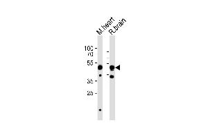 Western blot analysis of lysates from mouse heart, rat brain tissue (from left to right), using CHRNB3 Antibody (Center) (ABIN6244215 and ABIN6577603).