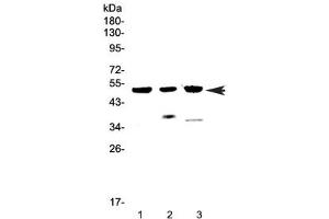 Western blot testing of 1) human MCF7, 2) rat heart and 3) mouse heart lysate with HTRA1 antibody at 0. (HTRA1 抗体)