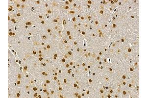TDP43 Mouse Monoclonal Antibody at 1/100 staining rat brain tissue by IHC-P.
