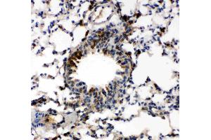 Anti-Caspase-6(P18) antibody, IHC(P): Mouse Lung Tissue (Caspase 6 抗体  (N-Term))