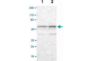 Western Blot analysis of Lane 1: RT-4 and Lane 2: U-251MG sp cell lysates with RBM23 polyclonal antibody . (RBM23 抗体)