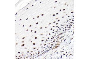 Immunohistochemistry of paraffin-embedded human normal cervix using CTCF Rabbit pAb (ABIN6130043, ABIN6139180, ABIN6139182 and ABIN6217207) at dilution of 1:100 (40x lens). (CTCF 抗体  (AA 1-260))