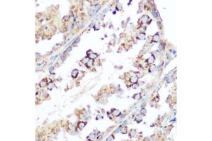Immunohistochemistry of paraffin-embedded mouse testis using Smac/Diablo Rabbit pAb (ABIN3023378, ABIN3023379, ABIN3023380 and ABIN6219667) at dilution of 1:100 (40x lens). (DIABLO 抗体  (AA 1-232))