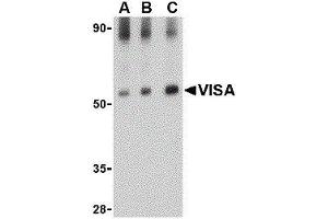 Western Blotting (WB) image for anti-Mitochondrial Antiviral Signaling Protein (MAVS) antibody (ABIN2477103) (MAVS 抗体)