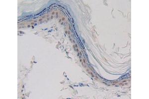 Used in DAB staining on fromalin fixed paraffin- embedded skin tissue (CASP14 抗体  (AA 1-246))