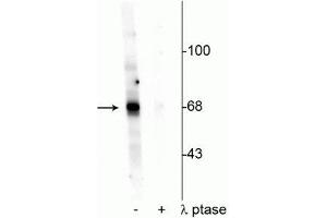 Western blot of Drosophila lysate showing specific labeling of the ~68 kDa AKT protein phosphorylated at Thr342 in the first lane (-). (AKT1 抗体  (pThr342))