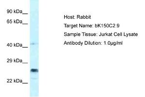 Host: Rabbit Target Name: bK150C2. (bK150C2.9 (C-Term) 抗体)