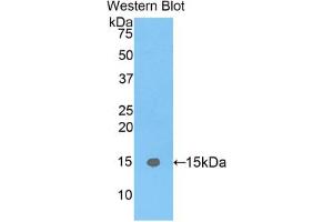 Western blot analysis of the recombinant protein. (FABP5 抗体  (AA 2-135))