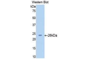 Detection of Recombinant SIRT4, Rat using Polyclonal Antibody to Sirtuin 4 (SIRT4) (SIRT4 抗体  (AA 60-255))