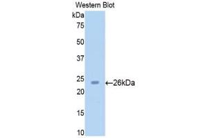Detection of Recombinant SIRT4, Rat using Polyclonal Antibody to Sirtuin 4 (SIRT4)