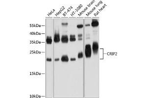 Western blot analysis of extracts of various cell lines, using CRIP2 Antibody (ABIN6130132, ABIN6139042, ABIN6139043 and ABIN6224870) at 1:1000 dilution. (CRIP2 抗体  (AA 1-208))