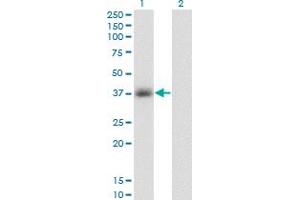 Western Blot analysis of GPD1 expression in transfected 293T cell line by GPD1 monoclonal antibody (M01), clone 3C10-1C4. (GPD1 抗体  (AA 1-349))