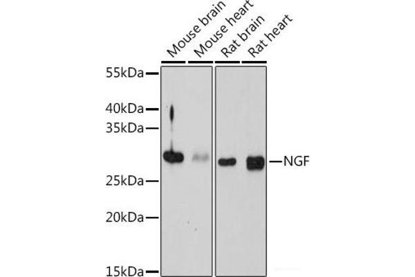 Nerve Growth Factor 抗体
