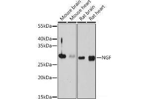 Western blot analysis of extracts of various cell lines using NGF Polyclonal Antibody at dilution of 1:1000. (Nerve Growth Factor 抗体)