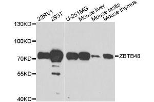 Western blot analysis of extracts of various cell lines, using ZBTB48 antibody. (ZBTB48 抗体  (AA 1-280))