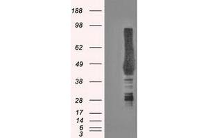 Western Blotting (WB) image for anti-Carbonic Anhydrase IX (CA9) antibody (ABIN1497095) (CA9 抗体)