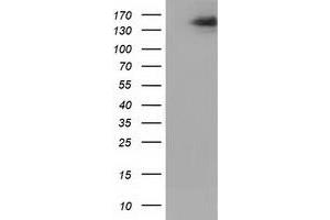 Western Blotting (WB) image for anti-L1 Cell Adhesion Molecule (L1CAM) antibody (ABIN1499087) (L1CAM 抗体)