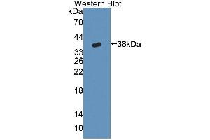 Western Blotting (WB) image for anti-Cytochrome P450, Family 17, Subfamily A, Polypeptide 1 (CYP17A1) (AA 201-507) antibody (ABIN7444853)