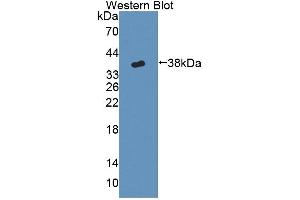 Detection of Recombinant CYP17A1, Mouse using Polyclonal Antibody to Cytochrome P450 17A1 (CYP17A1) (CYP17A1 抗体  (AA 201-507))