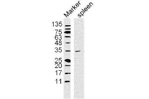 Western Blotting (WB) image for anti-Nuclear Factor of kappa Light Polypeptide Gene Enhancer in B-Cells Inhibitor, alpha (NFKBIA) (AA 1-120) antibody (ABIN674454)