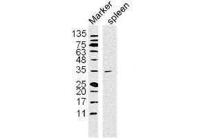 Lane 1: Mouse Spleen lysates probed with NFKBIA/IKB alpha Polyclonal Antibody, Unconjugated  at 1:300 overnight at 4˚C. (NFKBIA 抗体  (AA 1-120))