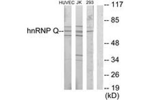 Western blot analysis of extracts from Jurkat/HuvEc/293 cells, using hnRNP Q Antibody. (SYNCRIP 抗体  (AA 236-285))