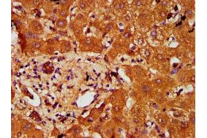IHC image of ABIN7164887 diluted at 1:200 and staining in paraffin-embedded human liver tissue performed on a Leica BondTM system.