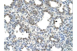 SLC26A5 antibody was used for immunohistochemistry at a concentration of 4-8 ug/ml. (SLC26A5 抗体)