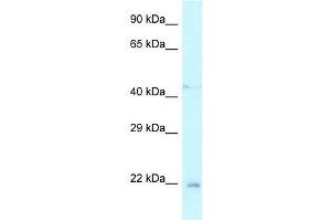 Western Blot showing Twist1 antibody used at a concentration of 1. (TWIST1 抗体  (N-Term))