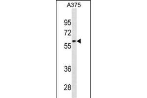 ZN Antibody (Center) (ABIN1882024 and ABIN2838879) western blot analysis in  cell line lysates (35 μg/lane). (ZNF394 抗体  (AA 287-316))