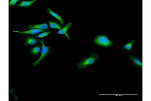 Immunofluorescence of purified MaxPab antibody to POR on HeLa cell.