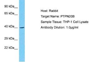 Western Blotting (WB) image for anti-Protein Tyrosine Phosphatase, Non-Receptor Type 20B (PTPN20B) (N-Term) antibody (ABIN2791887)