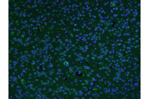 Paraformaldehyde-fixed, paraffin embedded Mouse brain Antigen retrieval by boiling in sodium citrate buffer (pH6. (AKAP12 抗体  (AA 701-900))