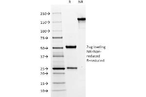 SDS-PAGE Analysis Purified MUC6 Mouse Monoclonal Antibody (CLH5). (MUC6 抗体)