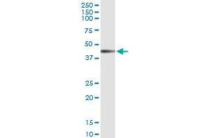 Immunoprecipitation of IL12RB1 transfected lysate using anti-IL12RB1 MaxPab rabbit polyclonal antibody and Protein A Magnetic Bead , and immunoblotted with IL12RB1 MaxPab mouse polyclonal antibody (B02) . (IL12RB1 抗体  (AA 1-381))