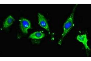 Immunofluorescent analysis of Hela cells using ABIN7160996 at dilution of 1:100 and Alexa Fluor 488-congugated AffiniPure Goat Anti-Rabbit IgG(H+L) (ME1 抗体  (AA 161-519))