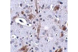 Immunohistochemistry of TTBK1 in mouse brain tissue with this product at 2. (TTBK1 抗体  (C-Term))