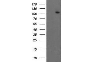 Western Blotting (WB) image for anti-Excision Repair Cross-Complementing Rodent Repair Deficiency, Complementation Group 4 (ERCC4) antibody (ABIN1498072) (ERCC4 抗体)
