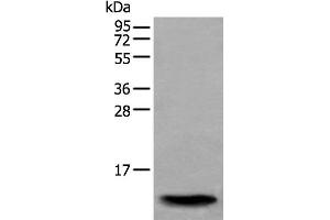 Western blot analysis of Human normal stomach tissue lysate using SAA4 Polyclonal Antibody at dilution of 1:350 (SAA4 抗体)