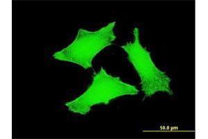 Immunofluorescence of monoclonal antibody to TCL1A on HeLa cell. (TCL1A 抗体  (AA 61-114))