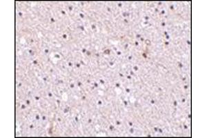 Immunohistochemistry of Nicastrin in human brain tissue with this product at 2. (Nicastrin 抗体  (Center))