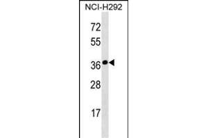 SYNPR Antibody (C-term) (ABIN1536817 and ABIN2850294) western blot analysis in NCI- cell line lysates (35 μg/lane). (Synaptoporin 抗体  (C-Term))