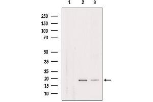 Western blot analysis of extracts from various samples, using RPL29 Antibody. (RPL29 抗体  (Internal Region))