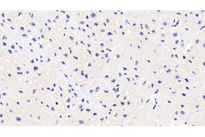 Detection of FKBP1A in Human Cardiac Muscle Tissue using Monoclonal Antibody to FK506 Binding Protein 1A (FKBP1A) (FKBP1A 抗体  (AA 2-108))
