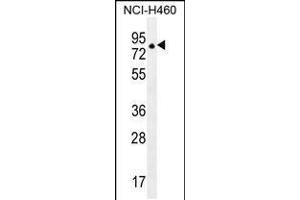 Western blot analysis in NCI-H460 cell line lysates (35ug/lane). (ZFP28 抗体  (N-Term))