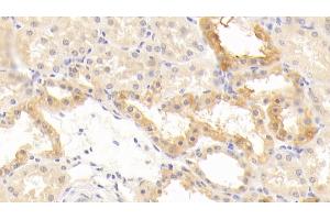 Detection of CD40L in Human Kidney Tissue using Polyclonal Antibody to Cluster Of Differentiation 40 Ligand (CD40L)